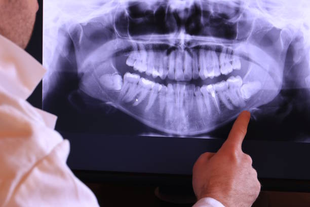 Best Broken or Chipped Tooth Repair in Meadow Glade, WA