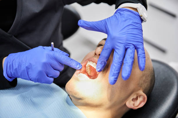 Best Emergency Root Canal Therapy in Meadow Glade, WA