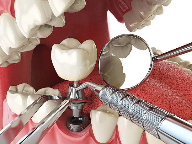  Meadow Glade, WA Emergency Dentist Pros